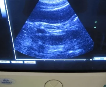 img.mjiwmtc1mzgy 792w