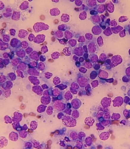 img.odewmduymdc1 792w